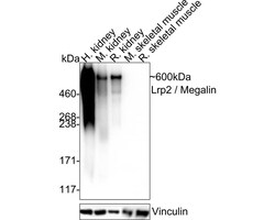LRP2 Antibody (PSH04-52), Novus Biologicals 100 &mu;L | Buy Online | Novus Biologicals | Fisher Scientific