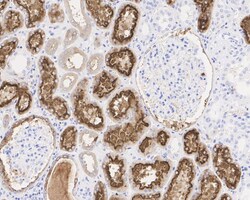 LRP2 Antibody (PSH04-52), Novus Biologicals 100 &mu;L | Buy Online | Novus Biologicals | Fisher Scientific