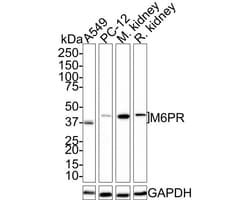CD-M6PR Antibody (PSH01-06), Novus Biologicals 100 &mu;L; Unconjugated:Antibodies,