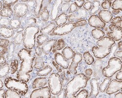 CD-M6PR Antibody (PSH01-06), Novus Biologicals 100 &mu;L; Unconjugated:Antibodies,