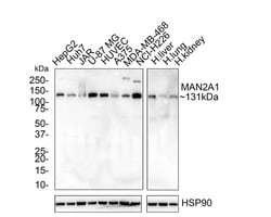 Alpha-mannosidase II Antibody (PSH02-67), Novus Biologicals 100 &mu;L;
