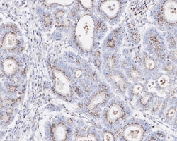 Alpha-mannosidase II Antibody (PSH02-67), Novus Biologicals 100 &mu;L;