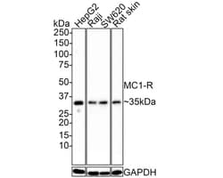 Melanocortin-1 R/MC1R Antibody (JE39-49), Novus Biologicals 100 &mu;L | Buy Online | Novus Biologicals | Fisher Scientific