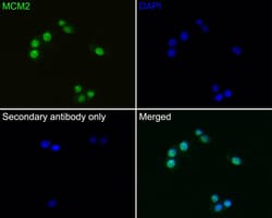 MCM2 Antibody (PD00-90), Novus Biologicals 100 &mu;L; Unconjugated:Anticorps,