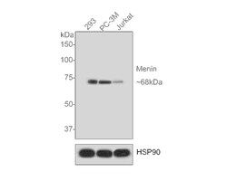 Menin Antibody (JE30-97), Novus Biologicals 100 &mu;L; Unconjugated:Antibodies,