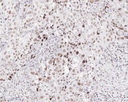 Menin Antibody (JE30-97), Novus Biologicals 100 &mu;L; Unconjugated:Antibodies,