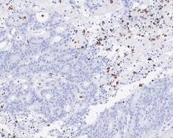 MMP-8 Antibody (JE59-38), Novus Biologicals 100 &mu;L | Buy Online | Novus Biologicals | Fisher Scientific