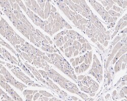 MPP1 Antibody (PSH02-69), Novus Biologicals 100 &mu;L; Unconjugated:Anticuerpos