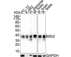 Musashi-2 Antibody (PSH01-17), Novus Biologicals 100 &mu;L; Unconjugated:Antibodies,