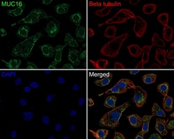 CA125/MUC16 Antibody (PD01-13), Novus Biologicals 100 &mu;L; Unconjugated:Antikörper