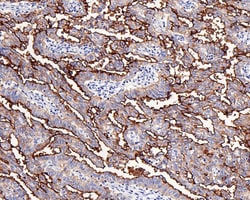 CA125/MUC16 Antibody (PD01-13), Novus Biologicals 100 &mu;L; Unconjugated:Antikörper