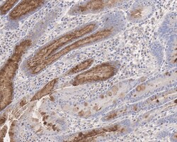 MUC5AC Antibody (A10G5-R), Novus Biologicals 100 &mu;L | Buy Online | Novus Biologicals | Fisher Scientific