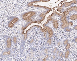 MUC5AC Antibody (A10G6-R), Novus Biologicals 100 &mu;L; Unconjugated:Antibodies,