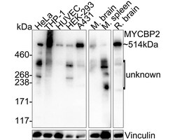 MYCBP2 Antibody (PSH03-68), Novus Biologicals 100 &mu;L; Unconjugated:Antibodies,