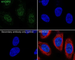 MYCBP2 Antibody (PSH03-68), Novus Biologicals 100 &mu;L; Unconjugated:Antibodies,