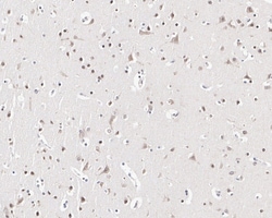 MYCBP2 Antibody (PSH03-68), Novus Biologicals 100 &mu;L; Unconjugated:Antibodies,