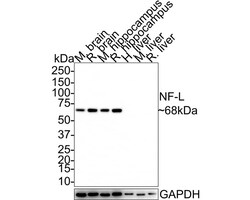 NF-L Antibody (PS02-10), Novus Biologicals 100 &mu;L; Unconjugated:Antibodies,
