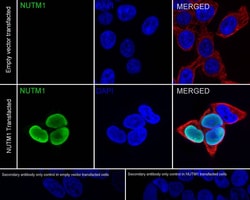 NUT Antibody, Novus Biologicals 100 &mu;L; Unconjugated:Antibodies, Monoclonal