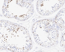 NUT Antibody, Novus Biologicals 100 &mu;L; Unconjugated:Antibodies, Monoclonal
