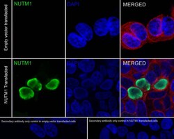 NUT Antibody (PSH02-78), Novus Biologicals 100 &mu;L; Unconjugated:Antibodies,
