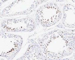 NUT Antibody (PSH02-78), Novus Biologicals 100 &mu;L; Unconjugated:Antibodies,