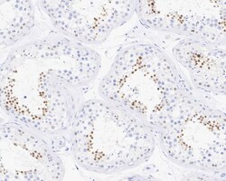 NUT Antibody (PSH03-36), Novus Biologicals 100 &mu;L; Unconjugated:Antibodies,