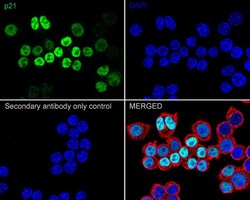 p21/CIP1/CDKN1A Antibody (PSH03-93), Novus Biologicals 100 &mu;L; Unconjugated:Antibodies,
