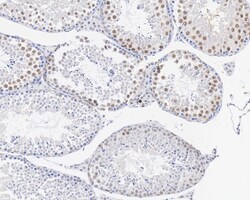 p21/CIP1/CDKN1A Antibody (PSH03-93), Novus Biologicals 100 &mu;L; Unconjugated:Antibodies,