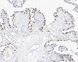 p21/CIP1/CDKN1A Antibody (A8C11-R), Novus Biologicals 100 &mu;L; Unconjugated:Antibodies,