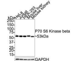 p70 S6 Kinase beta/S6K2 Antibody (JE35-69), Novus Biologicals 100 &mu;L;