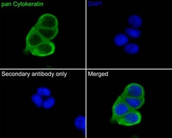 Cytokeratin, pan Antibody (PD00-15), Novus Biologicals 100 &mu;L; Unconjugated:Antibodies,