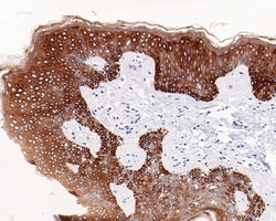 Cytokeratin, pan Antibody (PD00-15), Novus Biologicals 100 &mu;L; Unconjugated:Antibodies,