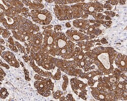 Cytokeratin, pan Antibody (PDH09-10), Novus Biologicals 100 &mu;L | Buy Online | Novus Biologicals | Fisher Scientific