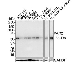 PAR2 Antibody (JE35-05), Novus Biologicals 100 &mu;L; Unconjugated:Antibodies,