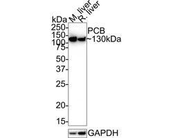 Pyruvate Carboxylase Antibody (JE40-24), Novus Biologicals 100 &mu;L | Buy Online | Novus Biologicals | Fisher Scientific