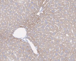 Pyruvate Carboxylase Antibody (JE40-24), Novus Biologicals 100 &mu;L | Buy Online | Novus Biologicals | Fisher Scientific