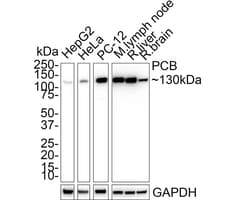 Pyruvate Carboxylase Antibody (PSH01-56), Novus Biologicals 100 &mu;L;