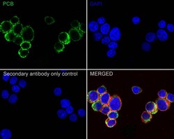 Pyruvate Carboxylase Antibody (PSH01-56), Novus Biologicals 100 &mu;L;