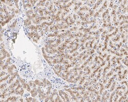 Pyruvate Carboxylase Antibody (PSH01-56), Novus Biologicals 100 &mu;L;