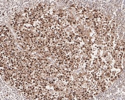 PCNA Antibody (A6-G11-R), Novus Biologicals 100 &mu;L; Unconjugated:Antibodies,