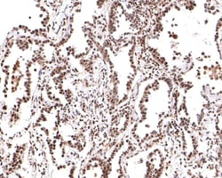 PER2 Antibody (JE33-79), Novus Biologicals 100 &mu;L; Unconjugated:Antibodies,