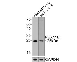 PEX11B Antibody (JE64-51), Novus Biologicals 100 &mu;L; Unconjugated:Antibodies,