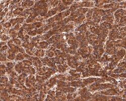 PEX11B Antibody (JE64-51), Novus Biologicals 100 &mu;L; Unconjugated:Antibodies,