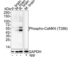 CaM Kinase II [p Thr286] Antibody (JE51-81), Novus Biologicals 100 &mu;L | Buy Online | Novus Biologicals | Fisher Scientific