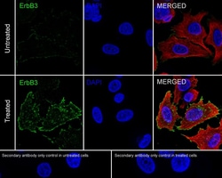 ErbB3/Her3 [p Tyr1289] Antibody (JE51-25), Novus Biologicals 100 &mu;L;