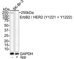 ErbB2/Her2 [p Tyr1221, p Tyr1222] Antibody (JE44-12), Novus Biologicals