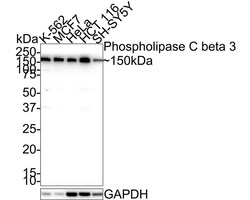 PLC-beta 3 Antibody (JE39-14), Novus Biologicals 100 &mu;L | Buy Online | Novus Biologicals | Fisher Scientific