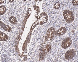 PLC-beta 3 Antibody (JE39-14), Novus Biologicals 100 &mu;L | Buy Online | Novus Biologicals | Fisher Scientific