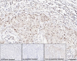 p38 alpha [p Thr180] Antibody (JE77-37), Novus Biologicals 100 &mu;L; Unconjugated:Antibodies,