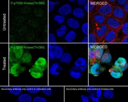p70 S6 Kinase/S6K [p Thr389] Antibody (PSH02-23), Novus Biologicals 100